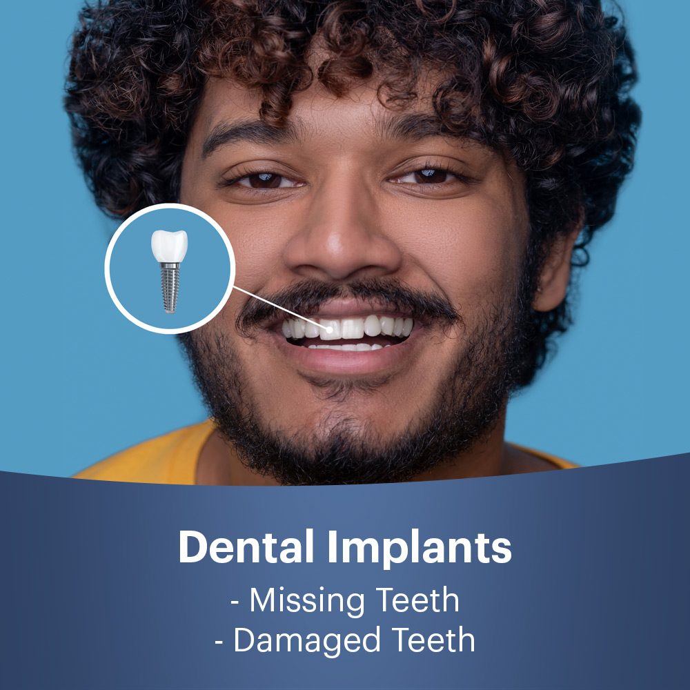 Dental Implants