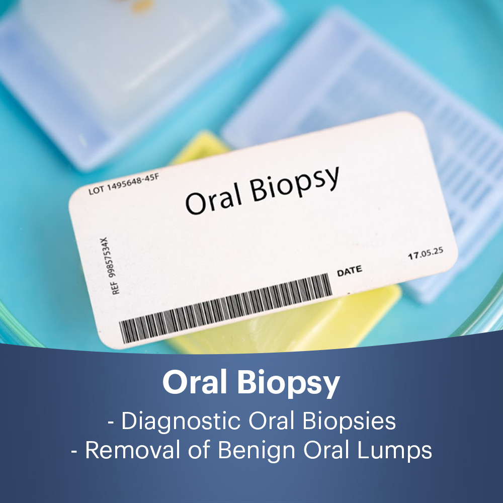 Oral Biopsy